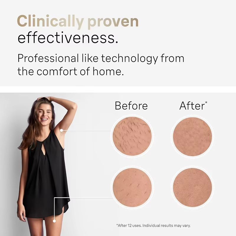 4'ü 1 arada Lazer Epilatör Lazer Epilasyon Cihazı 99999 Atış