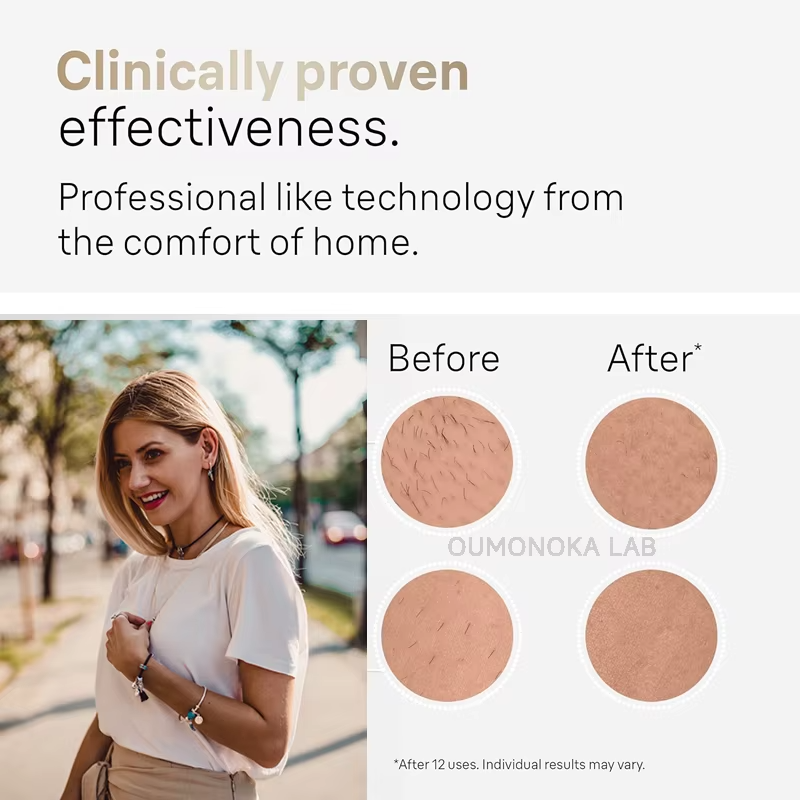 4'ü 1 arada Lazer Epilatör Fotoepilatör Epilasyon Cihazı Buz Lazer